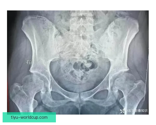 威廉姆斯耻骨炎毁赛季半速困局 威廉姆斯耻骨炎毁赛季半速困局